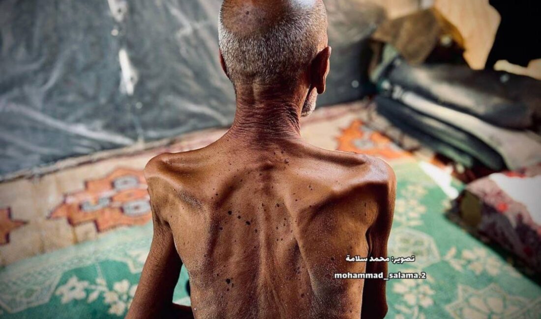 1.5 milyarlık İslam Aleminin yalnızlığa terk ettiği Gazze'de yaşlılar, bebekler,